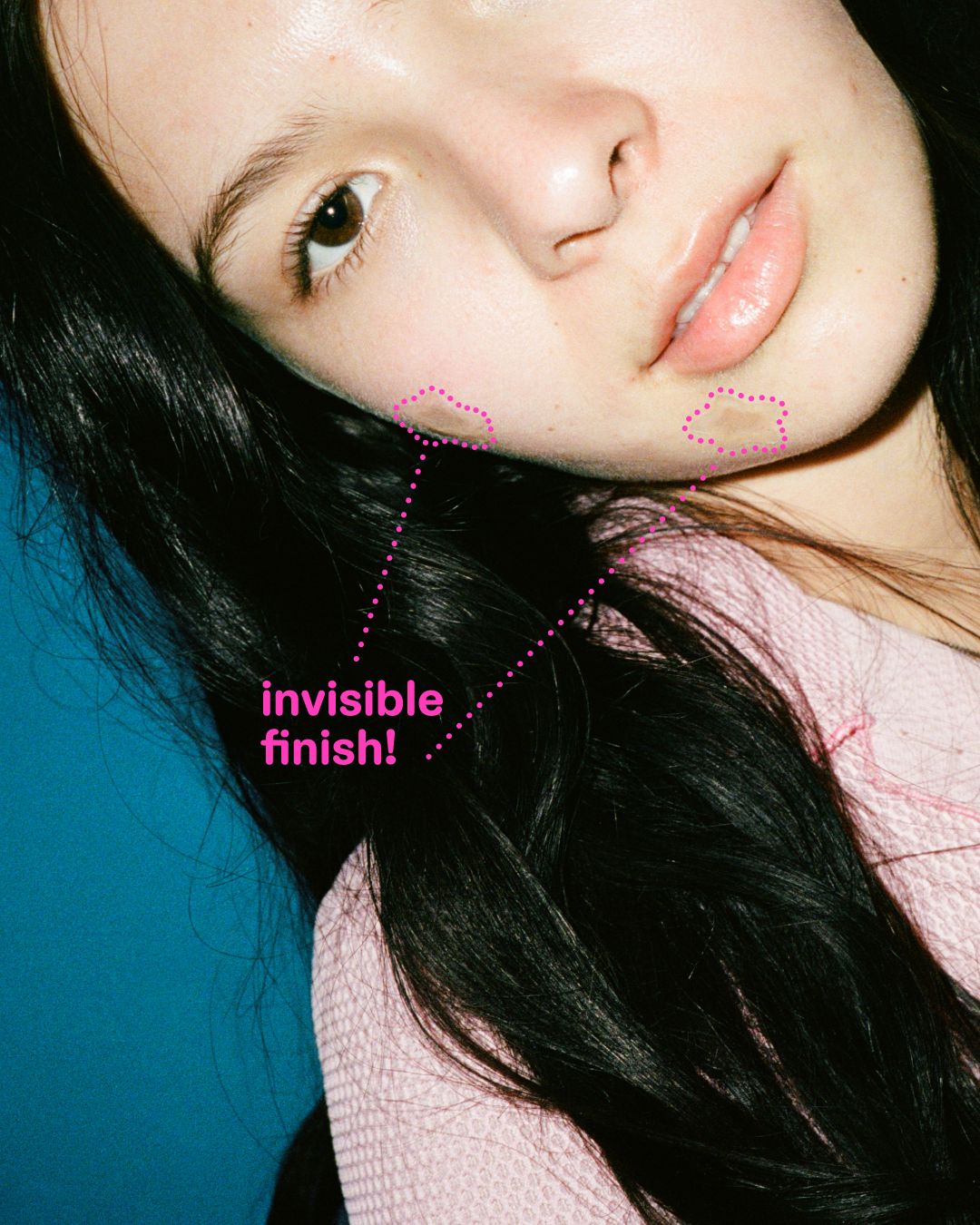 A person wearing clear Starface Hydro-Star® Microdarts + Salicylic Acid patches. Star patches for early-stage pimples.