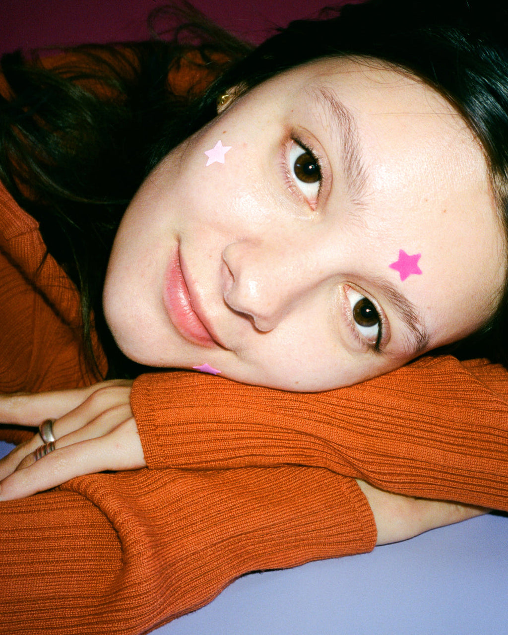 Closeup of pink Starface Hydro-Star® star-shaped pimple patches on a spot. Hydrocolloid patches that shrink pimples.