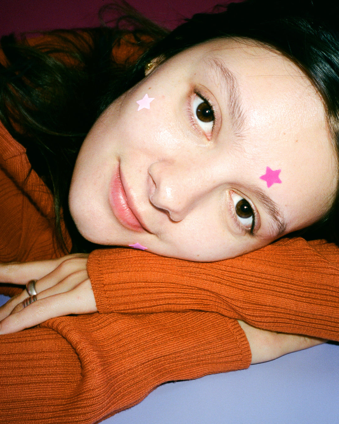 Closeup of pink Starface Hydro-Star® star-shaped pimple patches on a spot. Hydrocolloid patches that shrink pimples.