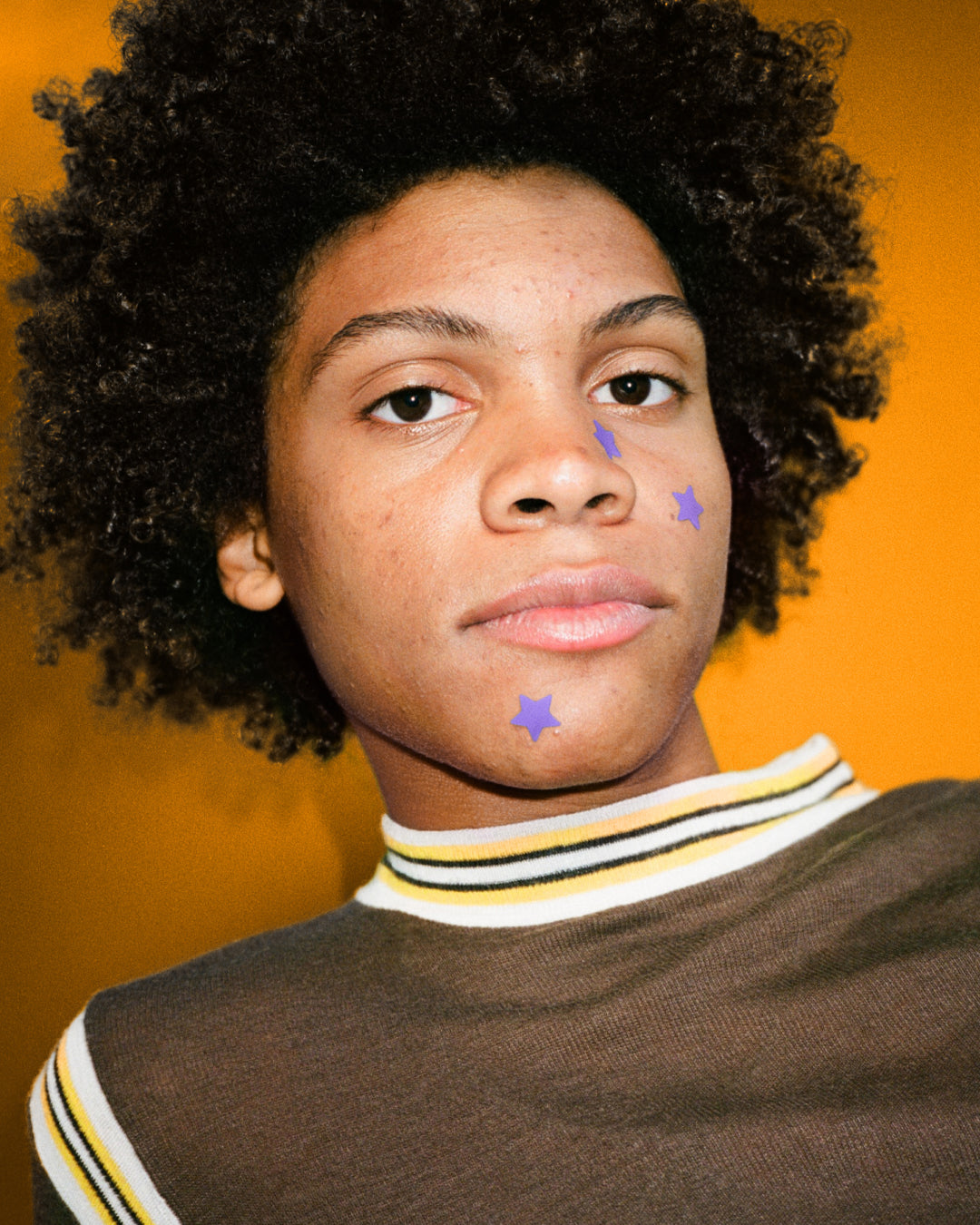 A person wearing purple Starface Hydro-Star® Recovery patches. Star-shaped patches that protect and soothe picked spots.