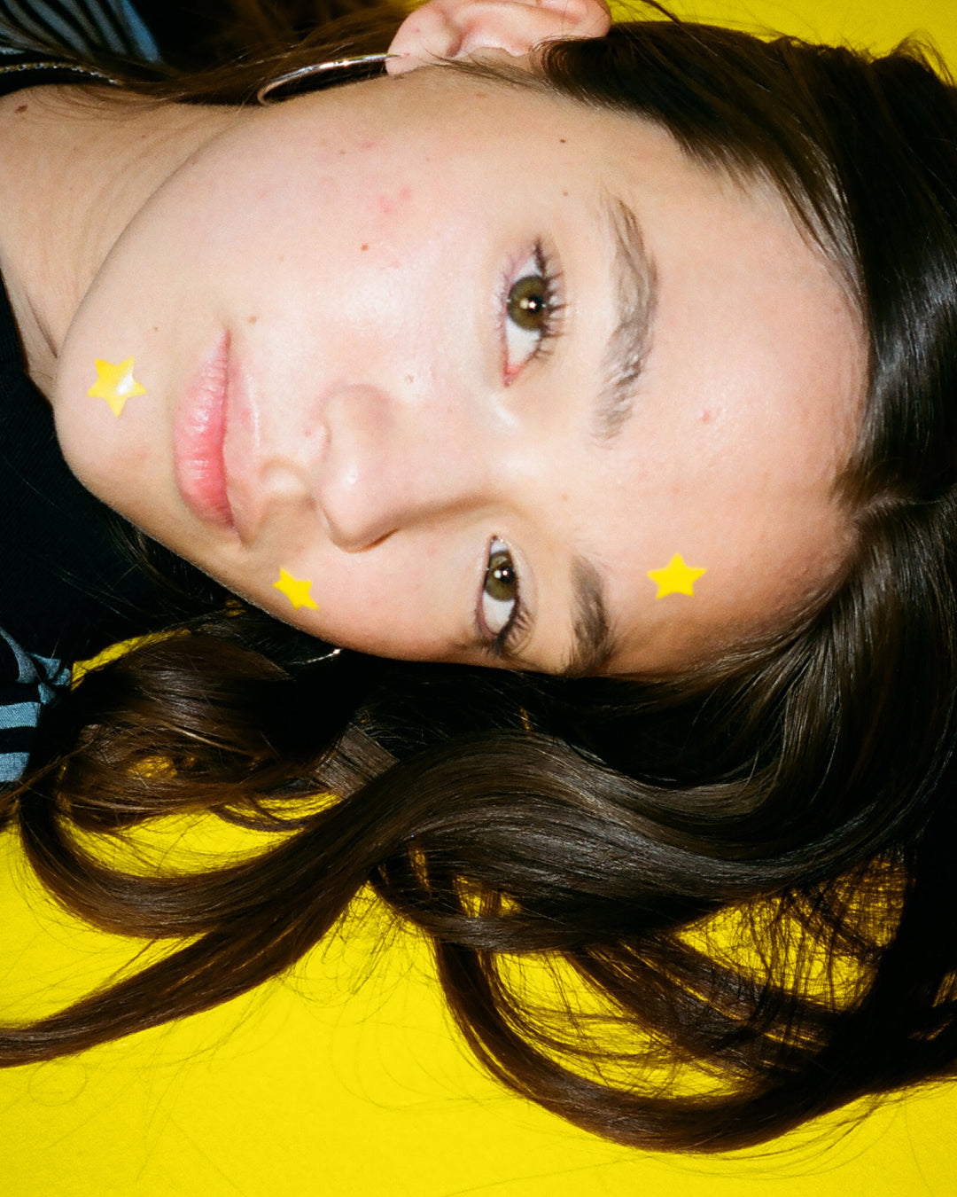 Closeup of yellow Starface Hydro-Star® star-shaped pimple patches on a spot. Hydrocolloid patches that shrink pimples.