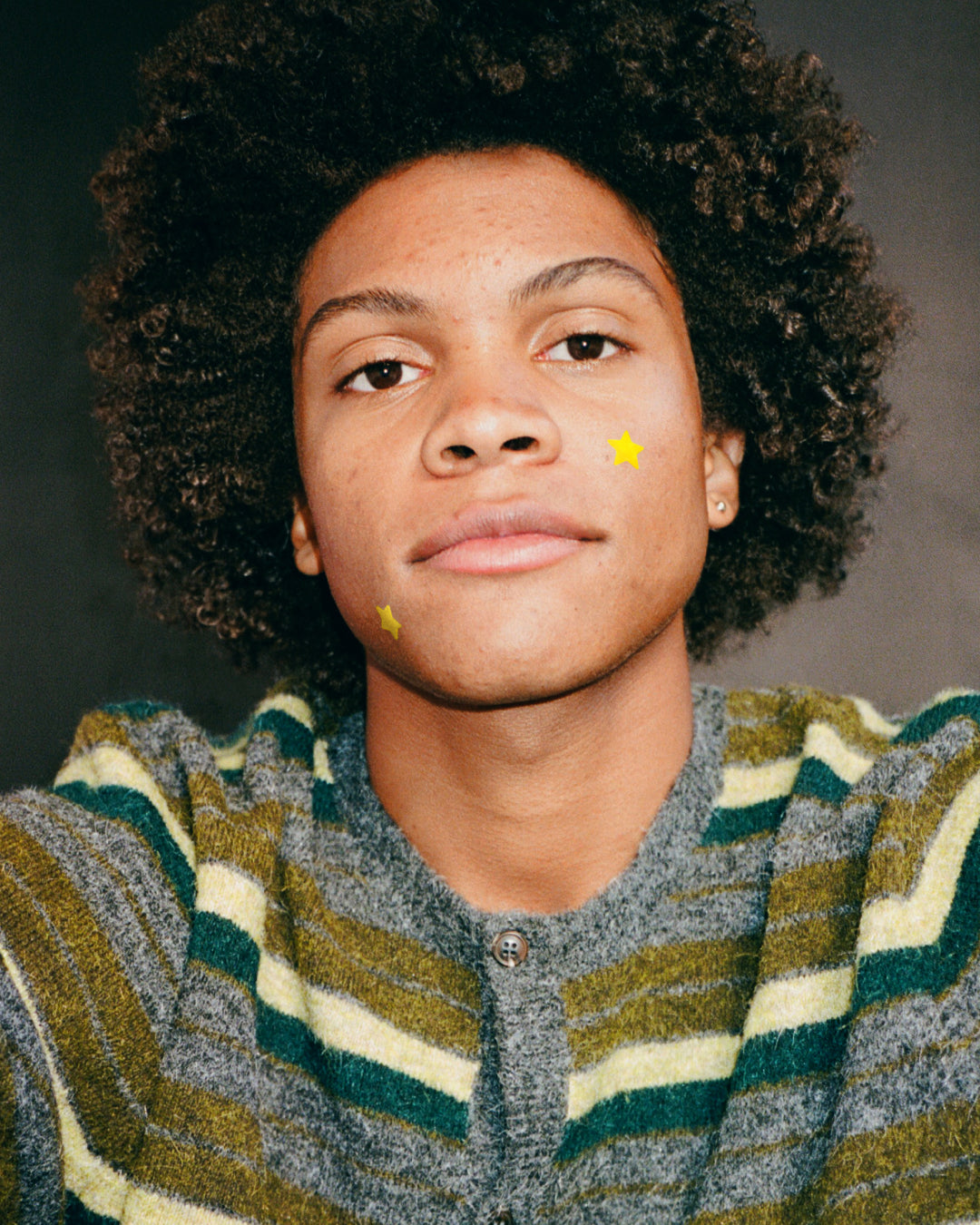 A person wearing yellow Starface Hydro-Star® pimple patches.